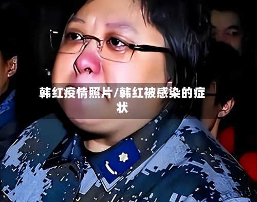 韩红疫情照片/韩红被感染的症状-第2张图片