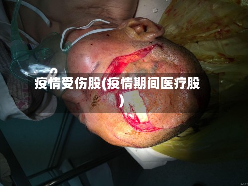 疫情受伤股(疫情期间医疗股)