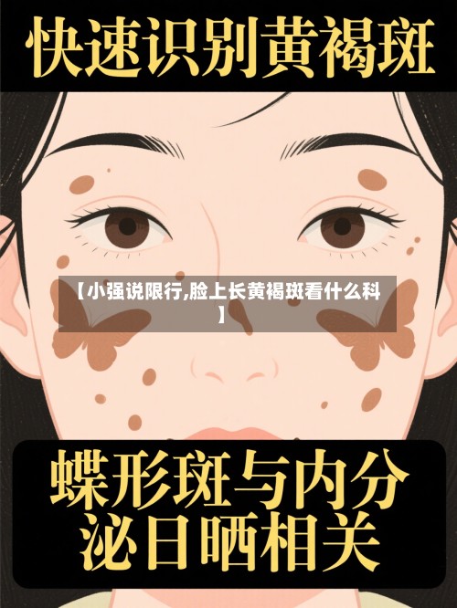 【小强说限行,脸上长黄褐斑看什么科】-第3张图片