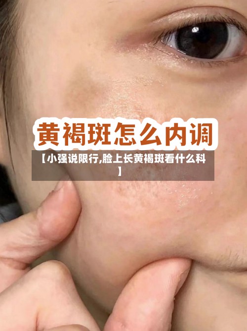 【小强说限行,脸上长黄褐斑看什么科】